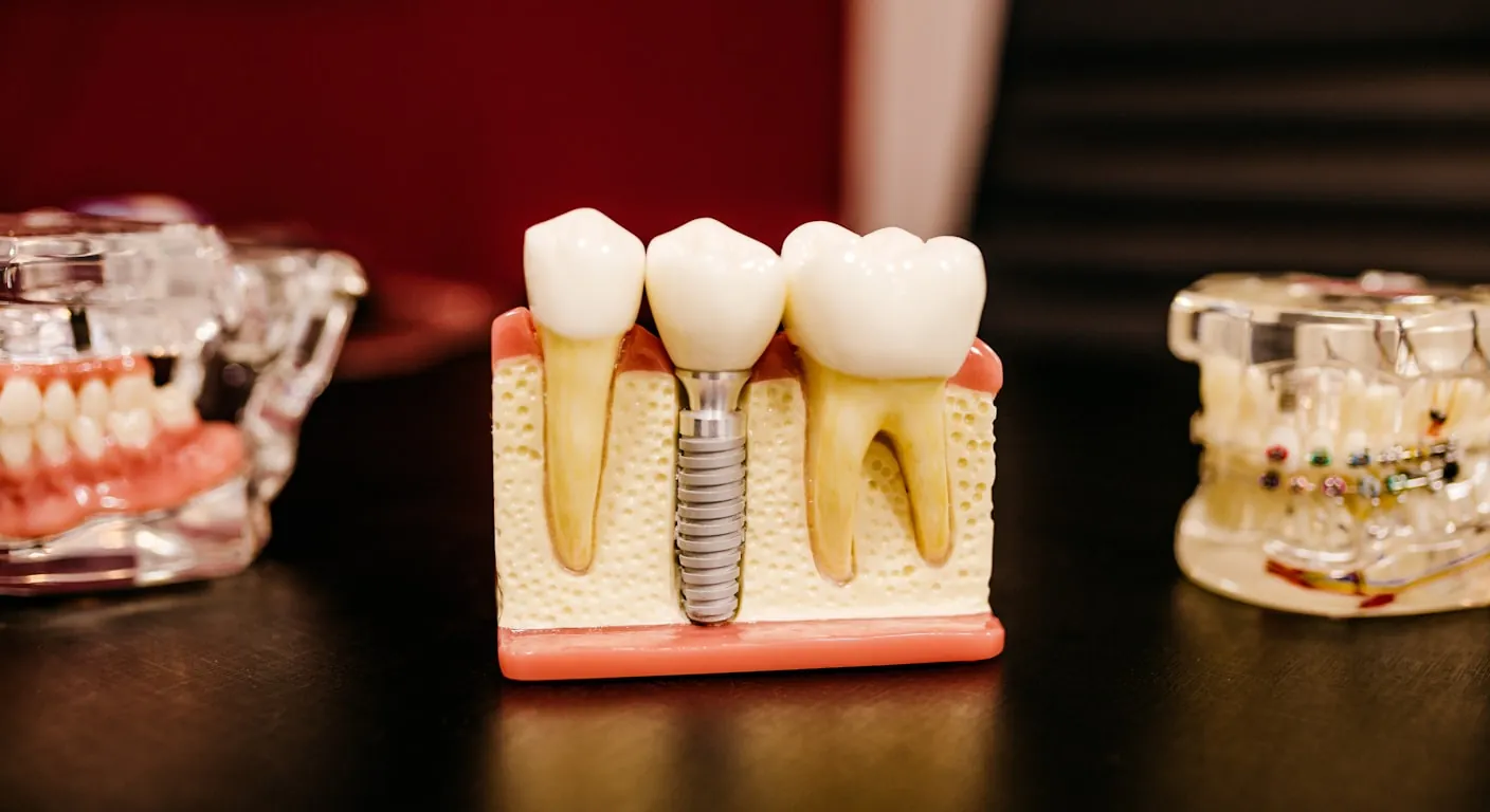 Dental implant procedure West Allis